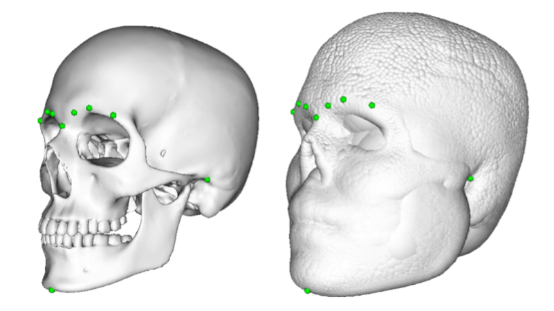 facial reconstruction