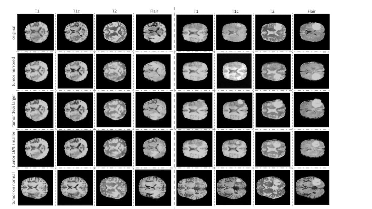 Примеры сгенерированных МРТ-снимков