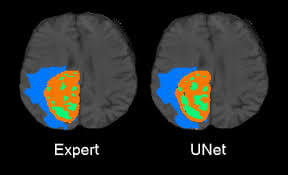 u-net medical segmentation